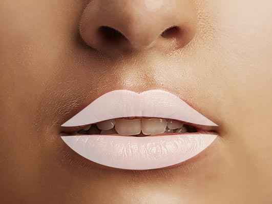 Lippen auffüllen und volle Lippen durch ästhetische Behandlung bei Solothurn