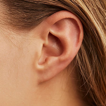 Segelohren entfernen schöne Ohren in Zuchwil